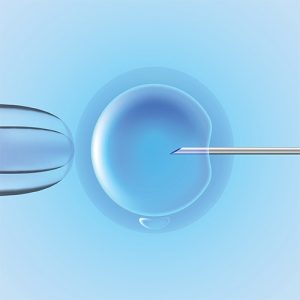 ICSI male infertility